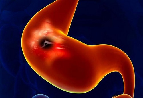 Как выглядит, фото