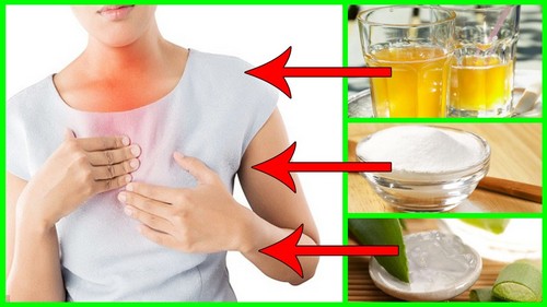 Изжога в горле