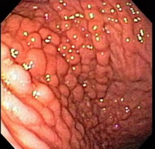 Как выглядит заболевание на фото