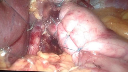 Операция у ребенка