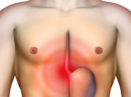 Как быть, если мучают боли в пищеводе