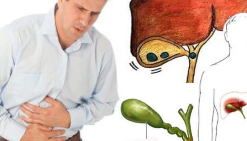 Воспаление желчного пузыря