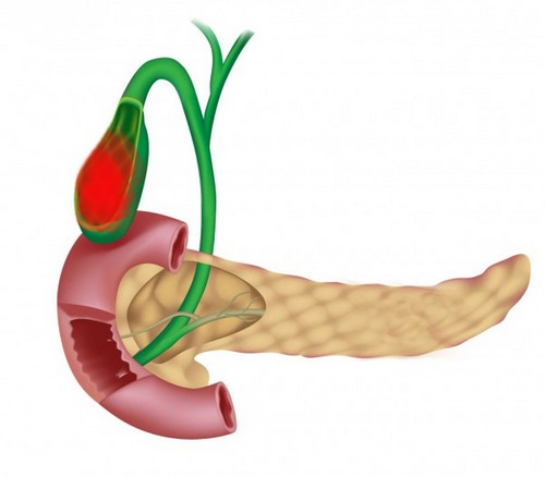 Приступ желчного пузыря